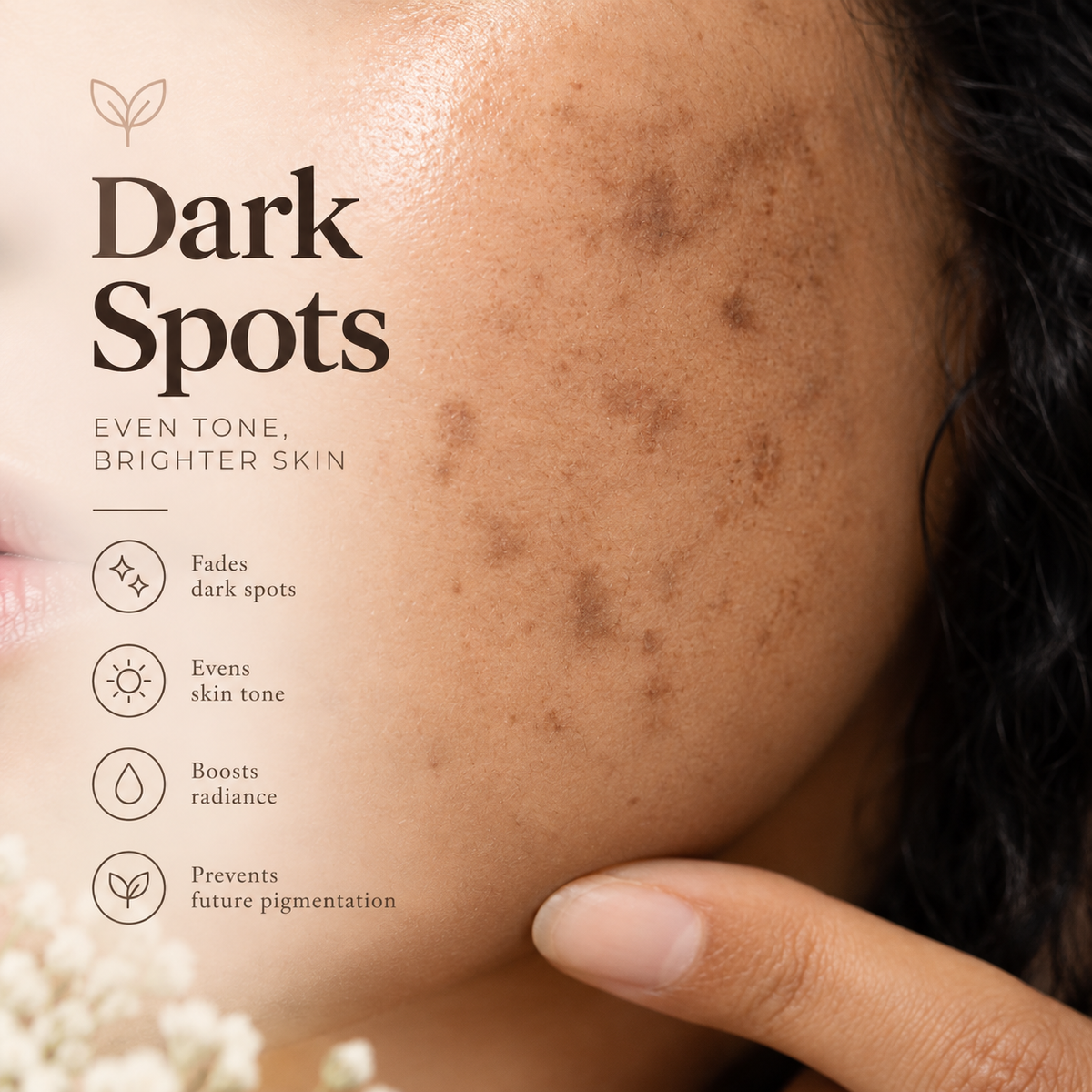 Dark Spots