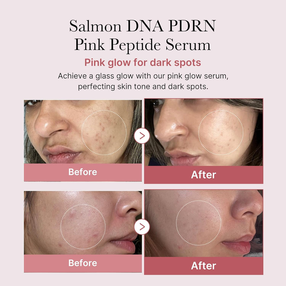 medicube - PDRN Pink Peptide Serum (30ml) | Salmon DNA Glow & Elasticity